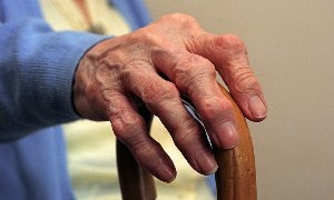 Artritis dan arthrosis jari pada orang tua. 