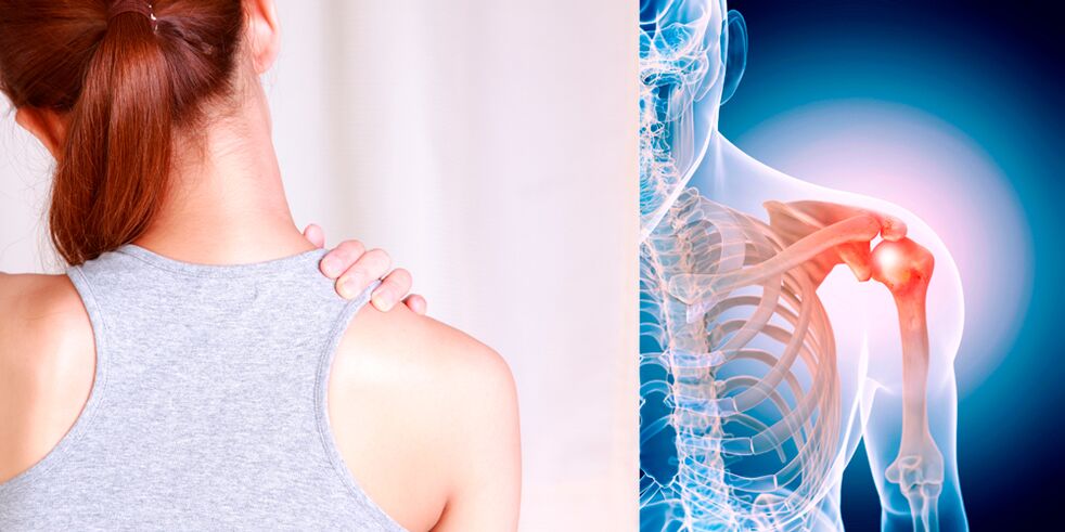 Perkembangan osteoarthritis bahu secara beransur-ansur membawa kepada kesakitan yang berterusan