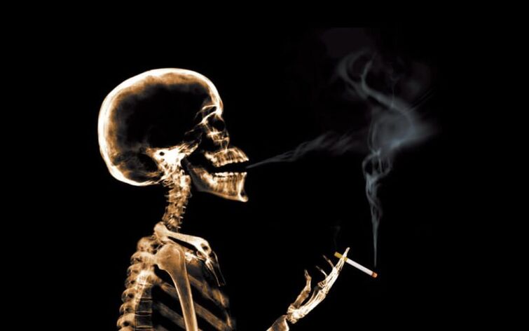 Merokok sebagai punca sakit belakang di bahagian tulang belikat