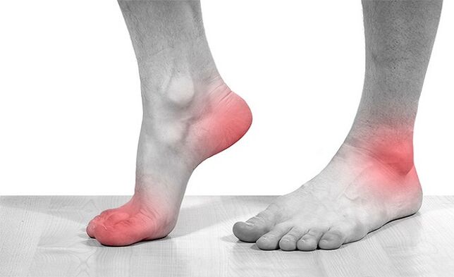 Sakit pada sendi pergelangan kaki dengan arthrosis