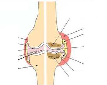 Mandi turpentin dan pain